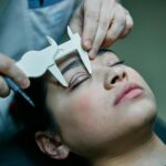 A surgeon measures a patient's eyelid for blepharoplasty preparations.